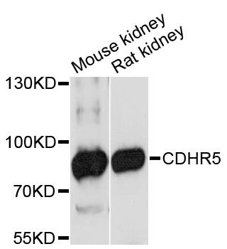 CDHR5 / MUCDHL Antibody - Western blot analysis of extracts of various cell lines, using CDHR5 antibody at 1:3000 dilution. The secondary antibody used was an HRP Goat Anti-Rabbit IgG (H+L) at 1:10000 dilution. Lysates were loaded 25ug per lane and 3% nonfat dry milk in TBST was used for blocking. An ECL Kit was used for detection and the exposure time was 90s.