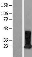 CDIPT Protein - Western validation with an anti-DDK antibody * L: Control HEK293 lysate R: Over-expression lysate