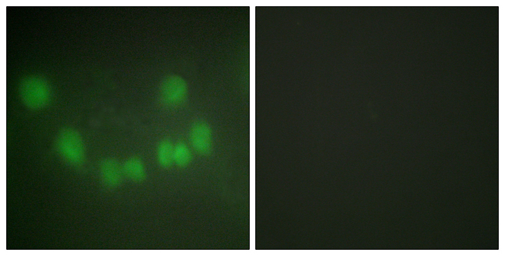 CDK1 / CDC2 Antibody - Immunofluorescence analysis of HUVEC cells, using CDC2 Antibody. The picture on the right is blocked with the synthesized peptide.