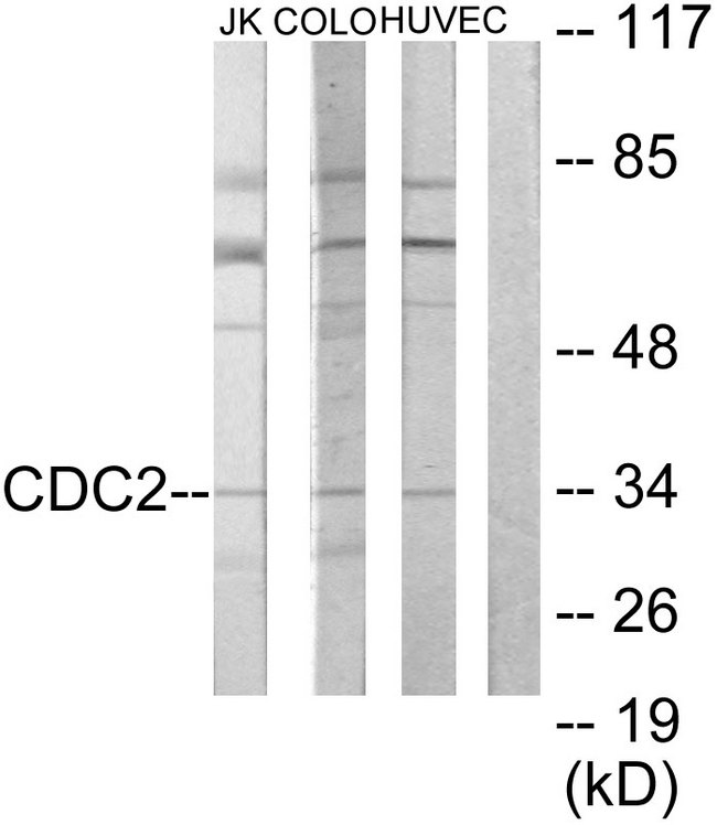 CDK1 / CDC2 Antibody - Western blot analysis of lysates from COLO205, HUVEC, and Jurkat cells, using CDC2 Antibody. The lane on the right is blocked with the synthesized peptide.