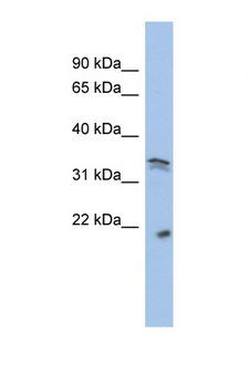 CDK1 / CDC2 Antibody - CDK1 antibody Western blot of SYSY Cell lysate. Antibody concentration 1 ug/ml. This image was taken for the unconjugated form of this product. Other forms have not been tested.