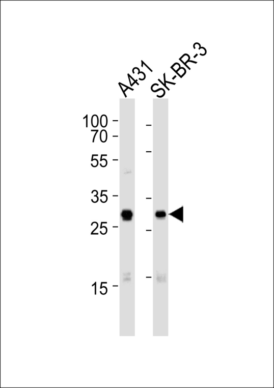 CDK1 / CDC2 Antibody - Western blot of lysates from A431, SK-BR-3 cell line (from left to right), using Mouse Cdk1 Antibody. Antibody was diluted at 1:1000 at each lane. A goat anti-rabbit IgG H&L (HRP) at 1:5000 dilution was used as the secondary antibody. Lysates at 35ug per lane.