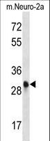 CDK1 / CDC2 Antibody - Mouse Cdk1 Antibody western blot of mouse Neuro-2a cell line lysates (35 ug/lane). The Cdk1 antibody detected the Cdk1 protein (arrow).