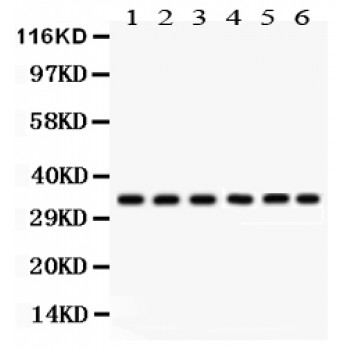 CDK1 / CDC2 Antibody - CDK1 antibody Western blot. All lanes: Anti CDK1 at 0.5 ug/ml. Lane 1: Rat Thymus Tissue Lysate at 50 ug. Lane 2: Rat Spleen Tissue Lysate at 50 ug. Lane 3: MCF-7 Whole Cell Lysate at 40 ug. Lane 4: HELA Whole Cell Lysate at 40 ug. Lane 5: JURKAT Whole Cell Lysate at 40 ug. Lane 6: NIH3T3 Whole Cell Lysate at 40 ug. Predicted band size: 34 kD. Observed band size: 34 kD.