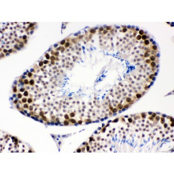CDK1 / CDC2 Antibody - CDK1 antibody IHC-paraffin. IHC(P): Mouse Testis Tissue.