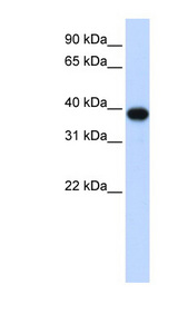 CDK1 / CDC2 Antibody - CDK1 antibody Western blot of 293T cell lysate. This image was taken for the unconjugated form of this product. Other forms have not been tested.