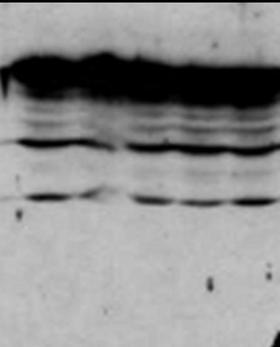 CDK1 / CDC2 Antibody - Anti-cdc2 Cyclin Dependent Kinase was used to detect human p34cdc2by Western blot of untreated (Control) and drug treated lysates of MCF-7 cells. Lane 1-4 represents 3.1 mM, 6.2 mM, 12.5 mM and 25.0 mM genistein treatment of cells before lysates were prepared. Detection occurs using a 1:1000 dilution. Although this antiserum detects non-specific bands at higher MW, a clear induction of signal is observed as the concentration of drug is increased.