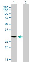 CDK1 / CDC2 Antibody - Western blot of CDC2 expression in transfected 293T cell line by CDC2 monoclonal antibody (M01), clone 1A4-1A9.