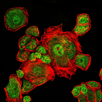 CDK1 / CDC2 Antibody - Immunofluorescence of Eca109 cells using CDK1 mouse monoclonal antibody (green). Red: Actin filaments have been labeled with Alexa Fluor-555 phalloidin.