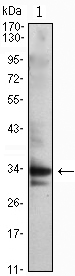 CDK1 / CDC2 Antibody - Western blot using CDC2 mouse monoclonal antibody against Jurkat (1) cell lysate.