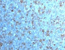CDK1 / CDC2 Antibody - IHC testing of formalin-fixed, paraffin-embedded human tonsil with Cdc2 antibody (CDK1/873).  This image was taken for the unmodified form of this product. Other forms have not been tested.
