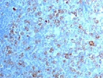 CDK1 / CDC2 Antibody - IHC testing of FFPE human tonsil with CDK1 antibody (clone CDVC2-1).  This image was taken for the unmodified form of this product. Other forms have not been tested.