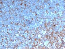 CDK1 / CDC2 Antibody - Cdk1 antibody POH-1 immunohistochemistry.  This image was taken for the unmodified form of this product. Other forms have not been tested.