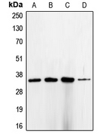 CDK1 / CDC2 Antibody - Western blot analysis of CDC2 expression in HeLa (A); K562 (B); MCF7 (C); A431 (D) whole cell lysates.