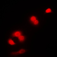CDK1 / CDC2 Antibody - Immunofluorescent analysis of CDC2 staining in K562 cells. Formalin-fixed cells were permeabilized with 0.1% Triton X-100 in TBS for 5-10 minutes and blocked with 3% BSA-PBS for 30 minutes at room temperature. Cells were probed with the primary antibody in 3% BSA-PBS and incubated overnight at 4 C in a humidified chamber. Cells were washed with PBST and incubated with a DyLight 594-conjugated secondary antibody (red) in PBS at room temperature in the dark. DAPI was used to stain the cell nuclei (blue).