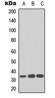 CDK1 / CDC2 Antibody - Western blot analysis of CDC2 expression in HepG2 (A); MCF7 (B); NIH3T3 (C) whole cell lysates.