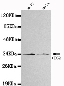 CDK1 / CDC2 Antibody - Western blot detection of CDC2/CDK1 in MCF7&Hela cell lysates using CDC2/CDK1 antibody (1:1000 diluted).