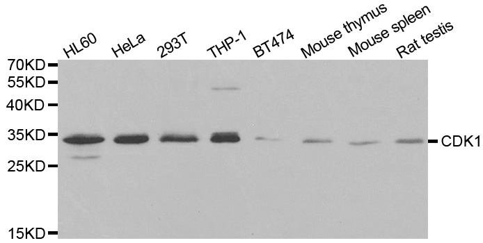 CDK1 / CDC2 Antibody - Western blot analysis of extracts of various cell lines, using CDK1 antibody at 1:1000 dilution. The secondary antibody used was an HRP Goat Anti-Rabbit IgG (H+L) at 1:10000 dilution. Lysates were loaded 25ug per lane and 3% nonfat dry milk in TBST was used for blocking.