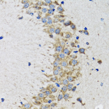 CDK1 / CDC2 Antibody - Immunohistochemistry of paraffin-embedded rat brain using CDK1 antibodyat dilution of 1:100 (40x lens).