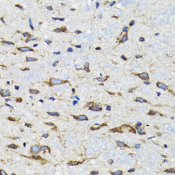 CDK1 / CDC2 Antibody - Immunohistochemistry of paraffin-embedded mouse spinal cord using CDK1 antibodyat dilution of 1:100 (40x lens).