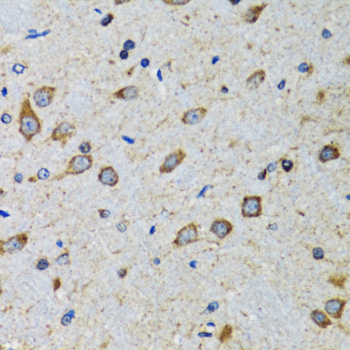 CDK1 / CDC2 Antibody - Immunohistochemistry of paraffin-embedded mouse brain using CDK1 antibodyat dilution of 1:100 (40x lens).