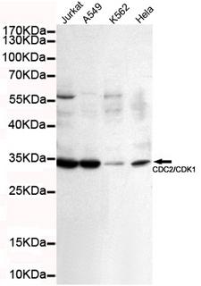 CDK1 / CDC2 Antibody - Western blot detection of CDC2/CDK1 in K562, A549, Jurkat and HeLa cell lysates using CDC2/CDK1 mouse monoclonal antibody (1:100 dilution). Predicted band size: 34KDa. Observed band size: 34KDa.