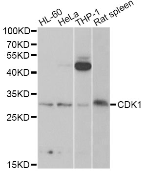 CDK1 / CDC2 Antibody - Western blot analysis of extracts of various cell lines, using CDK1 antibody at 1:1000 dilution. The secondary antibody used was an HRP Goat Anti-Rabbit IgG (H+L) at 1:10000 dilution. Lysates were loaded 25ug per lane and 3% nonfat dry milk in TBST was used for blocking. An ECL Kit was used for detection and the exposure time was 60s.