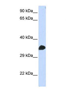 CDK1 / CDC2 Antibody - CDK1 antibody Western blot of Fetal Muscle lysate. Antibody concentration 1 ug/ml. This image was taken for the unconjugated form of this product. Other forms have not been tested.