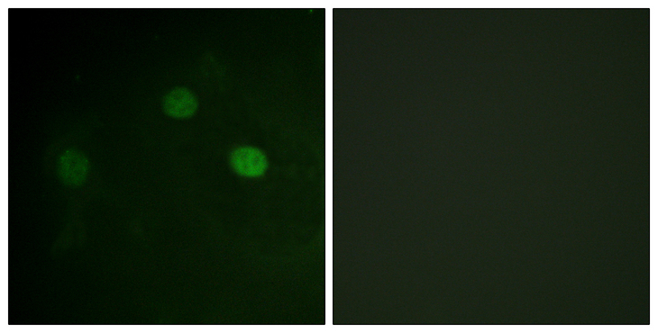 CDK1 / CDC2 Antibody - Immunofluorescence analysis of COS7 cells, using CDK1/CDC2 (Phospho-Thr14) Antibody. The picture on the right is blocked with the phospho peptide.