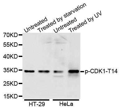 CDK1 / CDC2 Antibody - Western blot analysis of extracts of various cell lines.