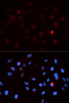 CDK1 / CDC2 Antibody - Immunofluorescence analysis of MCF7 cells.