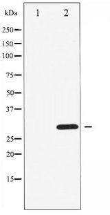CDK1 / CDC2 Antibody - Western blot of CDK1/CDC2 phosphorylation expression in Forskolin treated HepG2 whole cell lysates,The lane on the left is treated with the antigen-specific peptide.