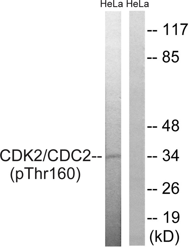 CDK1 / CDC2 Antibody - Western blot analysis of lysates from HeLa cells, using CDC2 (Phospho-Thr161) Antibody. The lane on the right is blocked with the phospho peptide.