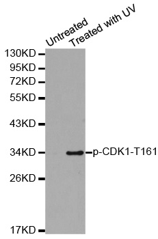 CDK1 / CDC2 Antibody - Western blot analysis of extracts from Hela cells.