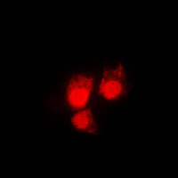 CDK1 / CDC2 Antibody - Immunofluorescent analysis of CDC2 (pT161) staining in HeLa cells. Formalin-fixed cells were permeabilized with 0.1% Triton X-100 in TBS for 5-10 minutes and blocked with 3% BSA-PBS for 30 minutes at room temperature. Cells were probed with the primary antibody in 3% BSA-PBS and incubated overnight at 4 C in a humidified chamber. Cells were washed with PBST and incubated with a DyLight 594-conjugated secondary antibody (red) in PBS at room temperature in the dark. DAPI was used to stain the cell nuclei (blue).