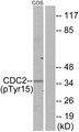 CDK1 / CDC2 Antibody - Western blot analysis of lysates from COS7 cells, using CDC2 (Phospho-Tyr15) Antibody. The lane on the right is blocked with the phospho peptide.