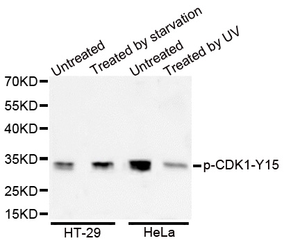 CDK1 / CDC2 Antibody - Western blot analysis of extracts from HeLa and HT-29 cells.
