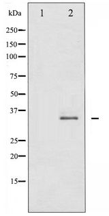 CDK1 / CDC2 Antibody - Western blot of CDC2 phosphorylation expression in HepG2 whole cell lysates,The lane on the left is treated with the antigen-specific peptide.