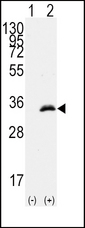 CDK1 / CDC2 Antibody - Western blot of CDK1(arrow) using rabbit polyclonal CDK1 Antibody (T14). 293 cell lysates (2 ug/lane) either nontransfected (Lane 1) or transiently transfected with the CDK1 gene (Lane 2) (Origene Technologies).