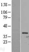 CDK1 / CDC2 Protein - Western validation with an anti-DDK antibody * L: Control HEK293 lysate R: Over-expression lysate