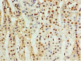 CDK10 Antibody - Immunohistochemistry of paraffin-embedded human adrenal gland using antibody at 1:100 dilution.