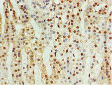 CDK10 Antibody - Immunohistochemistry of paraffin-embedded human adrenal gland using antibody at 1:100 dilution.