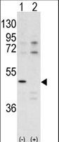 CDK10 Antibody - Western blot of CDK10 antibody pre-incubated with (Lane1) and without (Lane 2) blocking peptide in A375 cell line lysate. CDK10 (arrow) was detected using the purified antibody.