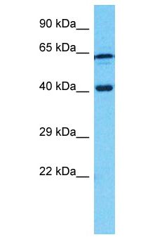 CDK10 Antibody - CDK10 antibody Western Blot of MCF7. Antibody dilution: 1 ug/ml.  This image was taken for the unconjugated form of this product. Other forms have not been tested.