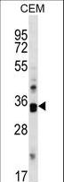 CDK10 Antibody - Mouse Cdk10 Antibody western blot of CEM cell line lysates (35 ug/lane). The Cdk10 antibody detected the Cdk10 protein (arrow).