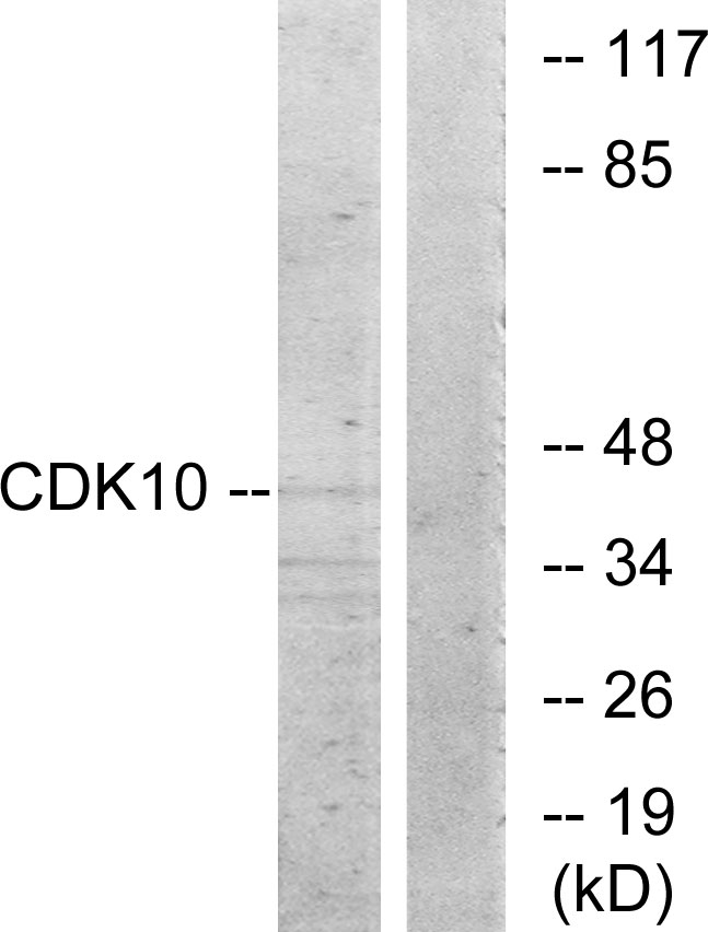 CDK10 Antibody - Western blot analysis of lysates from 293 cells, using CDK10 Antibody. The lane on the right is blocked with the synthesized peptide.