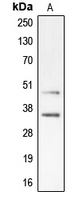 CDK10 Antibody - Western blot analysis of CDK10 expression in Jurkat (A) whole cell lysates.