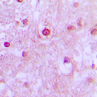 CDK10 Antibody - Immunohistochemical analysis of CDK10 staining in human brain formalin fixed paraffin embedded tissue section. The section was pre-treated using heat mediated antigen retrieval with sodium citrate buffer (pH 6.0). The section was then incubated with the antibody at room temperature and detected using an HRP conjugated compact polymer system. DAB was used as the chromogen. The section was then counterstained with hematoxylin and mounted with DPX.