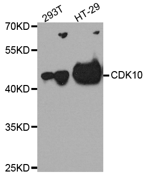 CDK10 Antibody - Western blot analysis of extract of various cells.