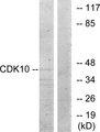 CDK10 Antibody - Western blot analysis of extracts from 293 cells, using CDK10 antibody.